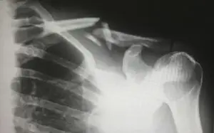 Hacking DICOM Medical Images