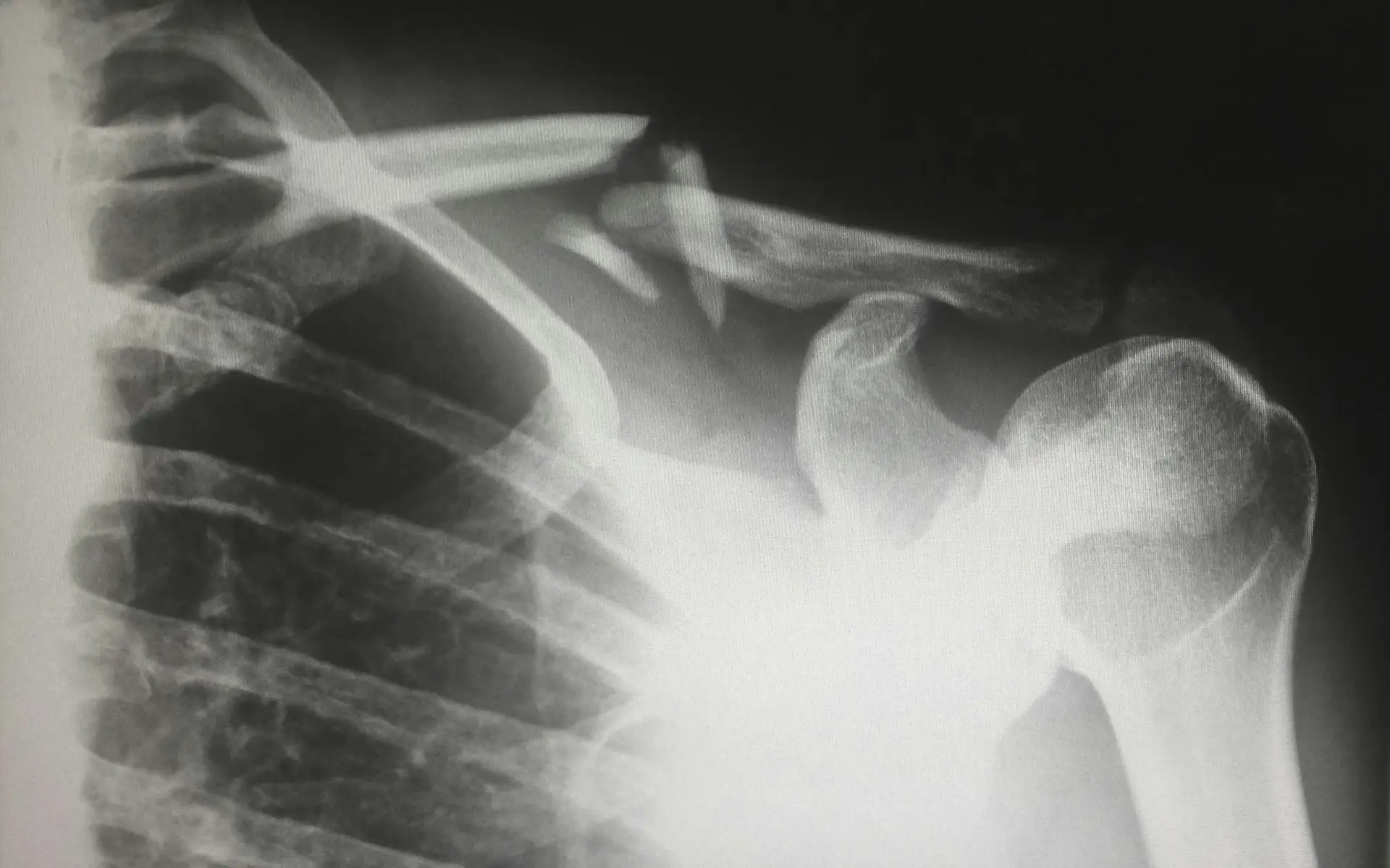 Primer article cover: Hacking DICOM Medical Images
